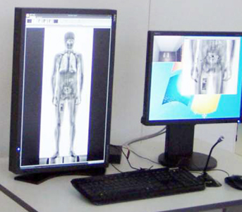 detection systems- X ray Body Scanner: Scanika